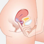 verify position of diaphragm