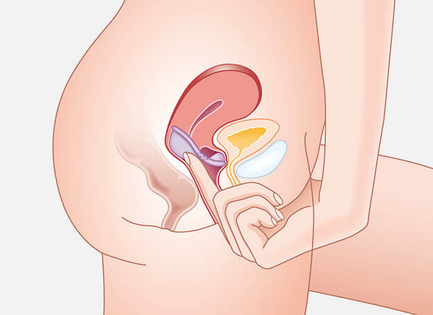 verify position of diaphragm