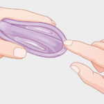 spreading gel for diagphram