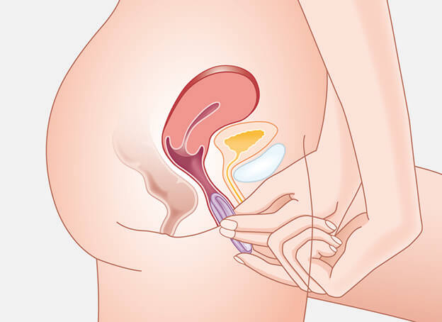 inserting the diaphragm is not difficult