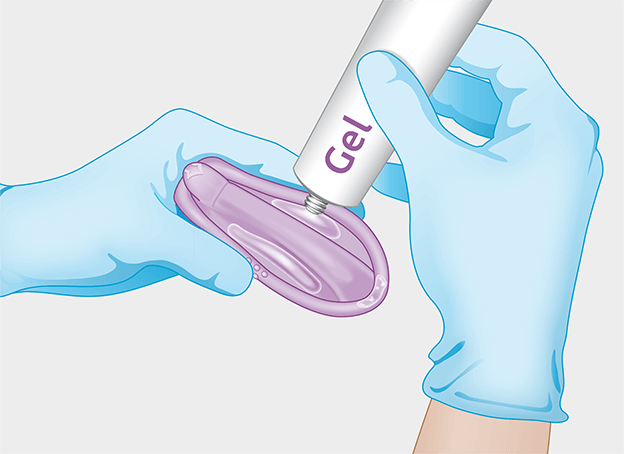 gel for diaphragm