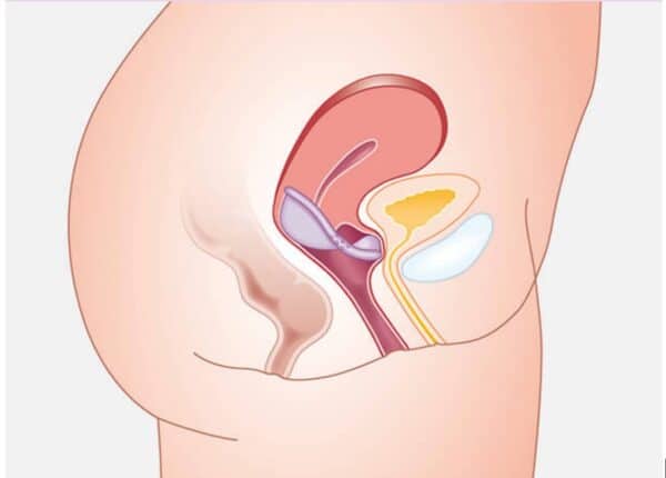 How a diaphragm works