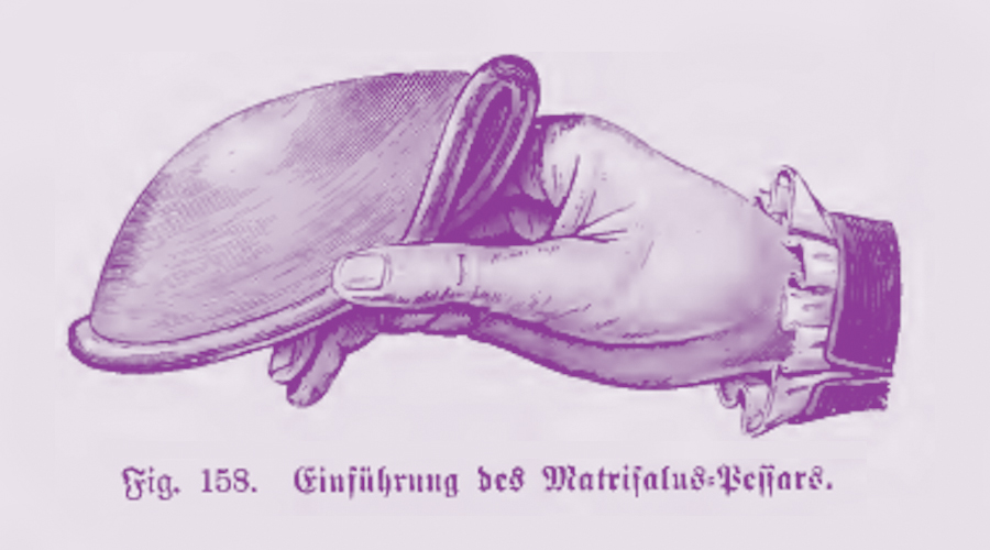 Illustration of a hand holding a female contraceptive diaphgram, drawn in an hold historical late 1800s style and colored to match Caya.